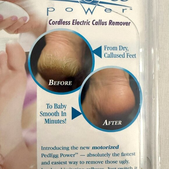 Ped Egg Power Cordless Electric Callus Remover Bonus Smoothing Head Soft Feet - Picture 8 of 10